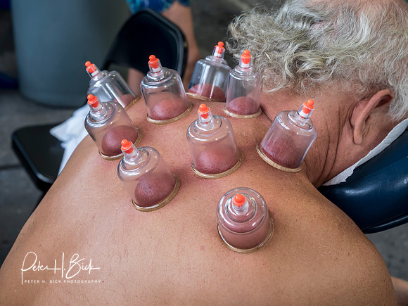 cupping-usms-panam-2018 2610